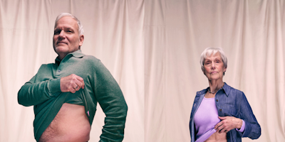 Kidney donor's lifting their t-shirts up to reveal their scars 